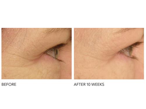 drx spectralite faceware pro by dr dennis gross