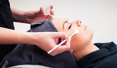 Microdermabrasion and Chemical Peels