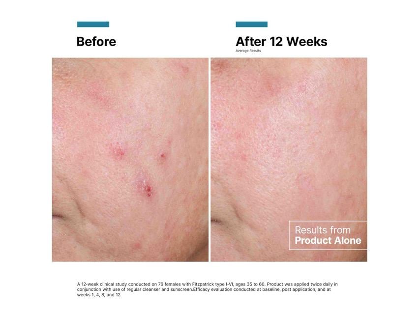 SkinCeuticals Advanced RGN-6 Aesthetic Recovery Cream