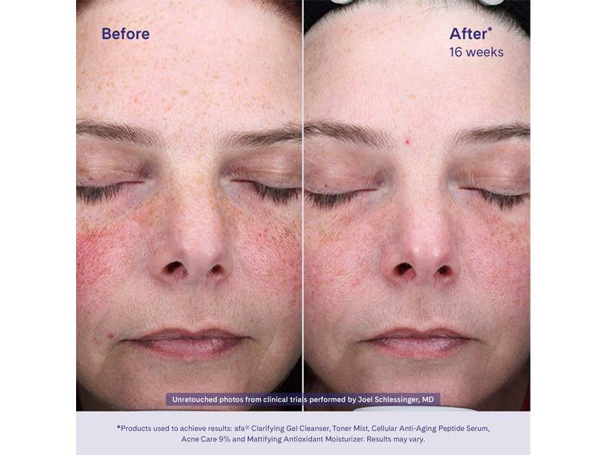 afa Clarifying Gel Cleanser