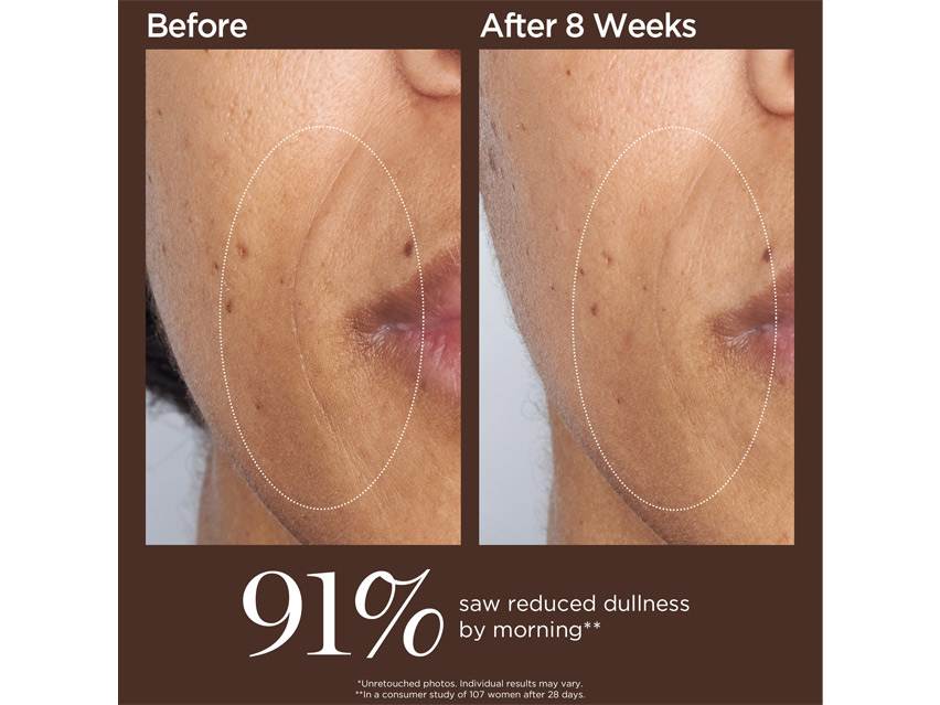 Perricone MD High Potency Retinol Recovery Overnight Moisturizer