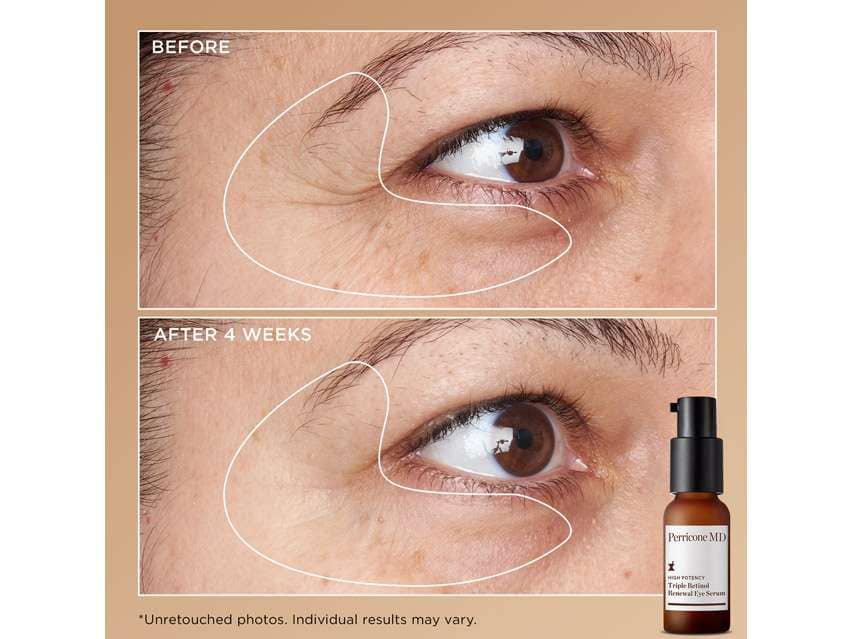 Perricone MD Triple Retinol Power Kit