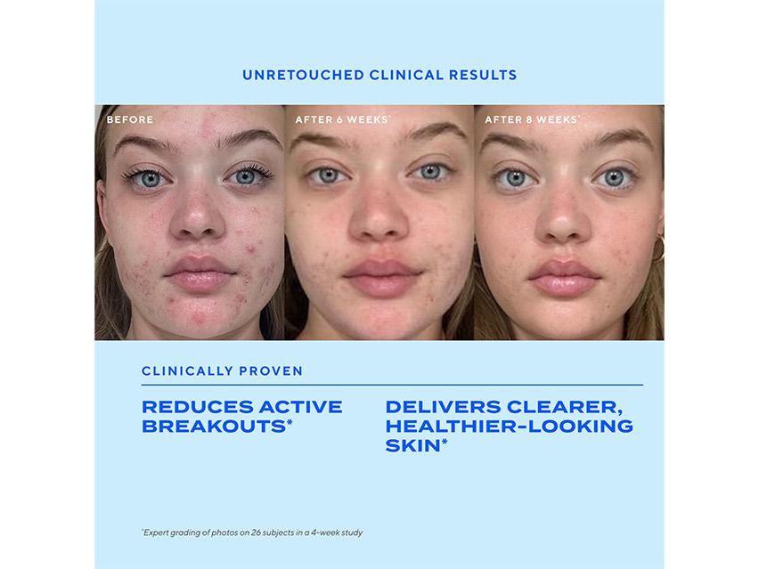 Murad Biome-Balancing Clear &amp; Prevent Acne Treatment Serum