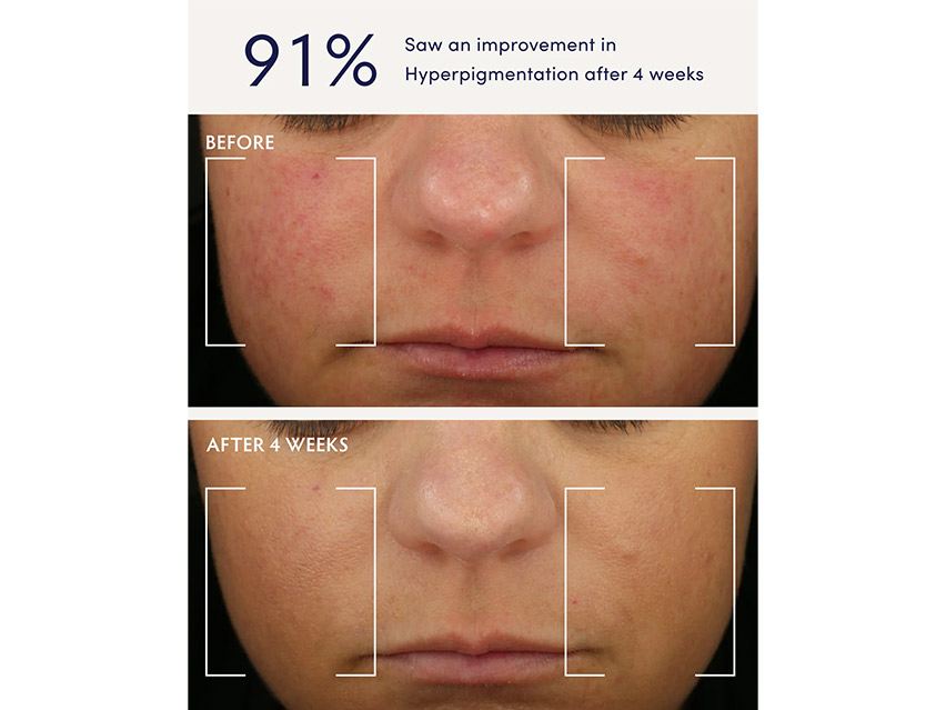 Naturopathica Holy Basil &amp; Bakuchiol Ageless Night Oil