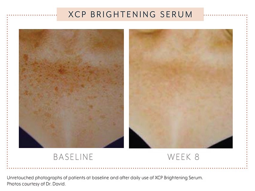 Biopelle Brighten XCP Brightening Serum