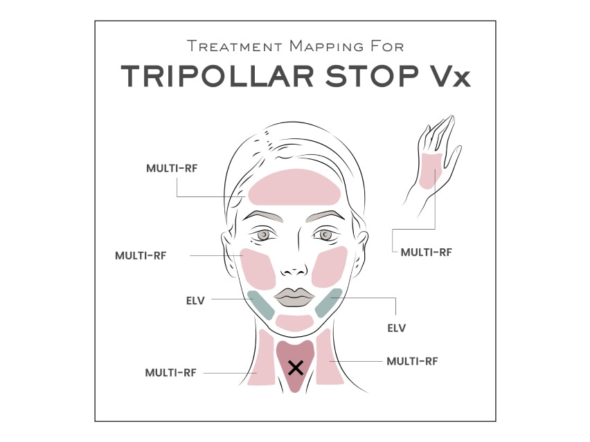TriPollar STOP Vx Facial Renewal & Rejuvenation Device