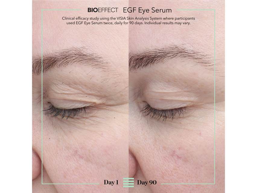 BIOEFFECT EGF Eye Serum