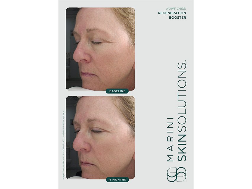 Marini SkinSolutions Regeneration Booster Face Lotion