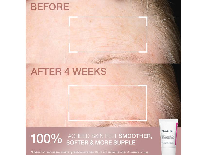 StriVectin Smooth &amp; Hydrate Kit - Limited Edition