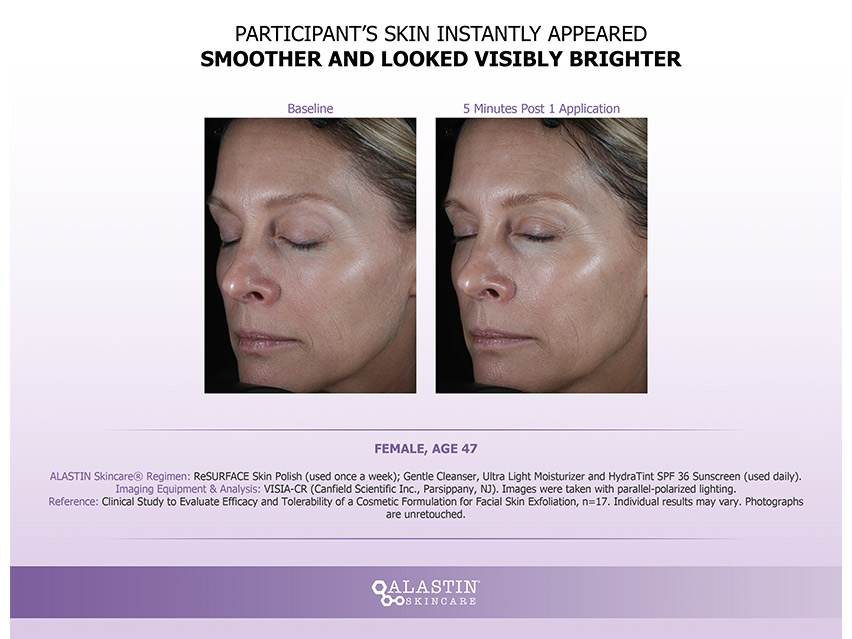 ALASTIN Skincare ReSURFACE Skin Polish