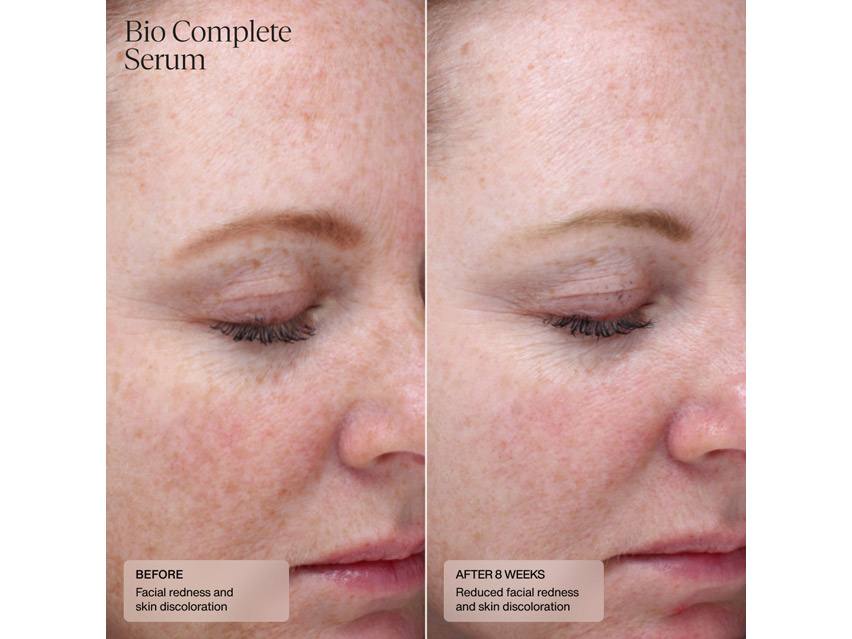 Sent&#233; Dermal Repair Cream &amp; Bio Complete Serum Duo - $203 Value!