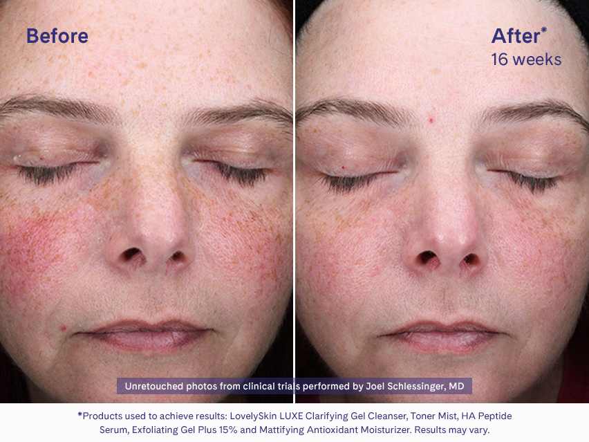 LovelySkin LUXE Ultra-Rich Peptide Moisturizer