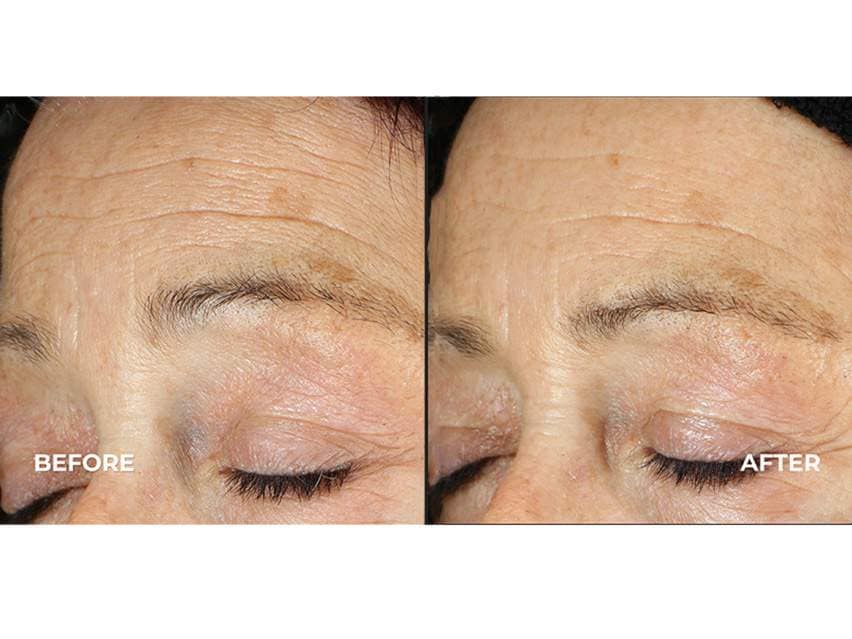 derma e Ultra Lift Concentrated Serum