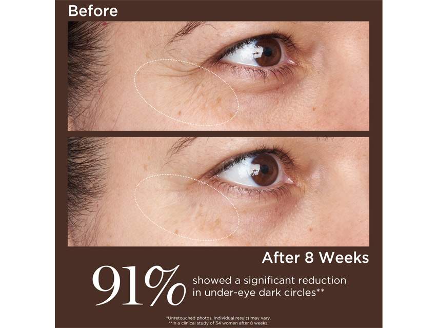 Perricone MD High Potency Triple Retinol Renewal Eye Serum