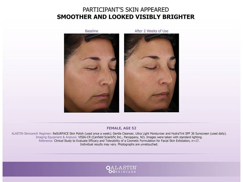 ALASTIN Skincare ReSURFACE Skin Polish