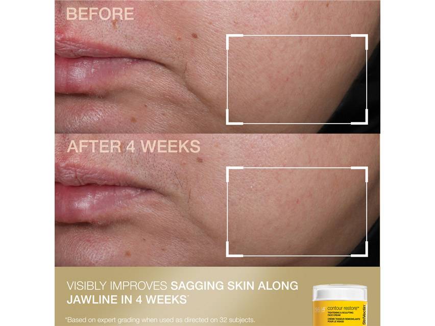 StriVectin Contour &amp; Tighten Kit - Limited Edition