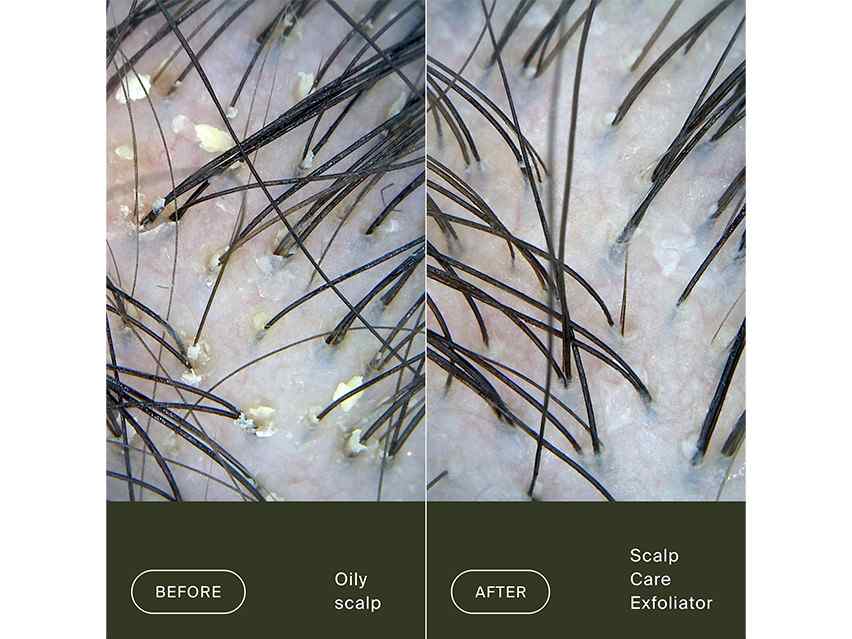Living Proof Scalp Care Exfoliator