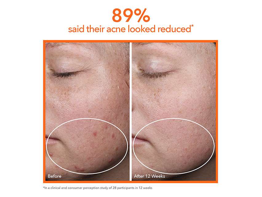 Dr. Dennis Gross Skincare DRx SpectraLite™ FaceWare Pro