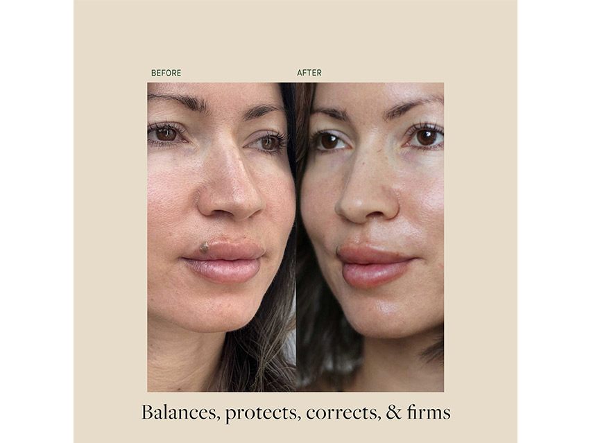 Kat Burki PH+ Enzyme Essence