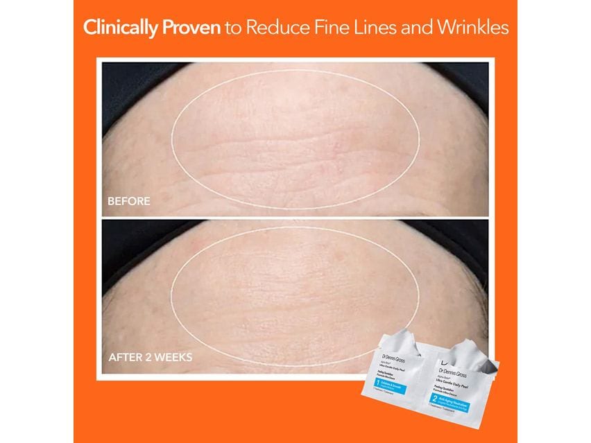 Dr. Dennis Gross Skincare Alpha Beta Ultra Gentle Daily Peel