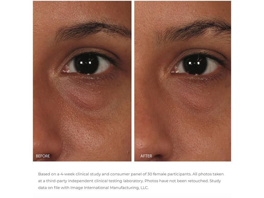 IMAGE Skincare Ormedic Balancing Eye Lift Gel