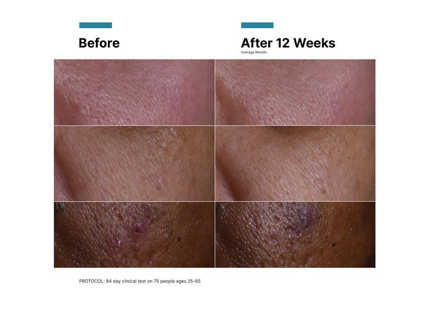 SkinCeuticals C E Ferulic Antioxidant Serum - New Patent-Pending Formula