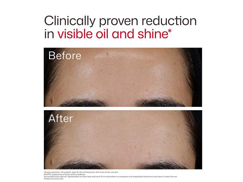 EltaMD UV Clear Blemish-Prone &amp; Oil Balancing SPF 50