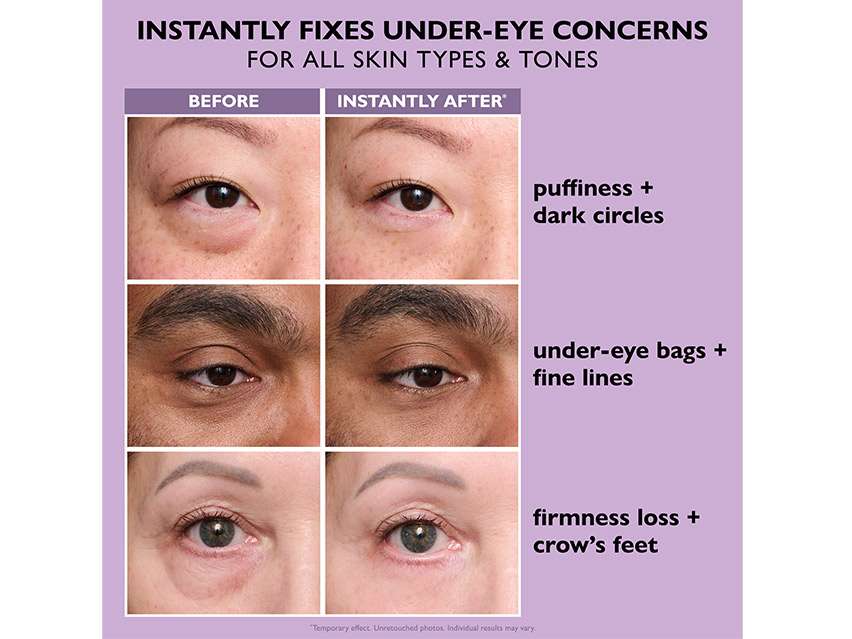 Peter Thomas Roth Instant Firmx Eye Temporary Eye Tightener - Easy-Wear Formula