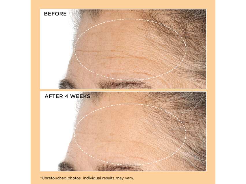 Perricone MD Neuropeptide Deep Crease Serum