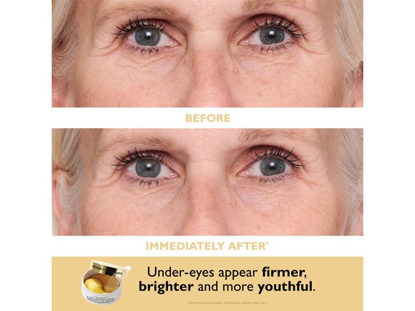 Peter Thomas Roth Patch &amp; Go Eye Patch Travel Pack - Limited Edition