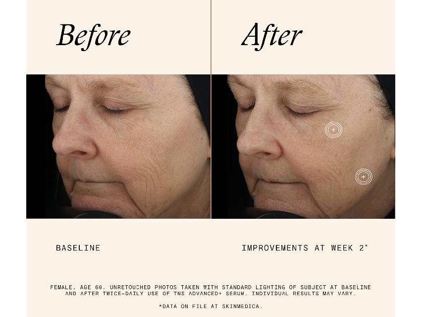 SkinMedica TNS&#174; Advanced+ Serum