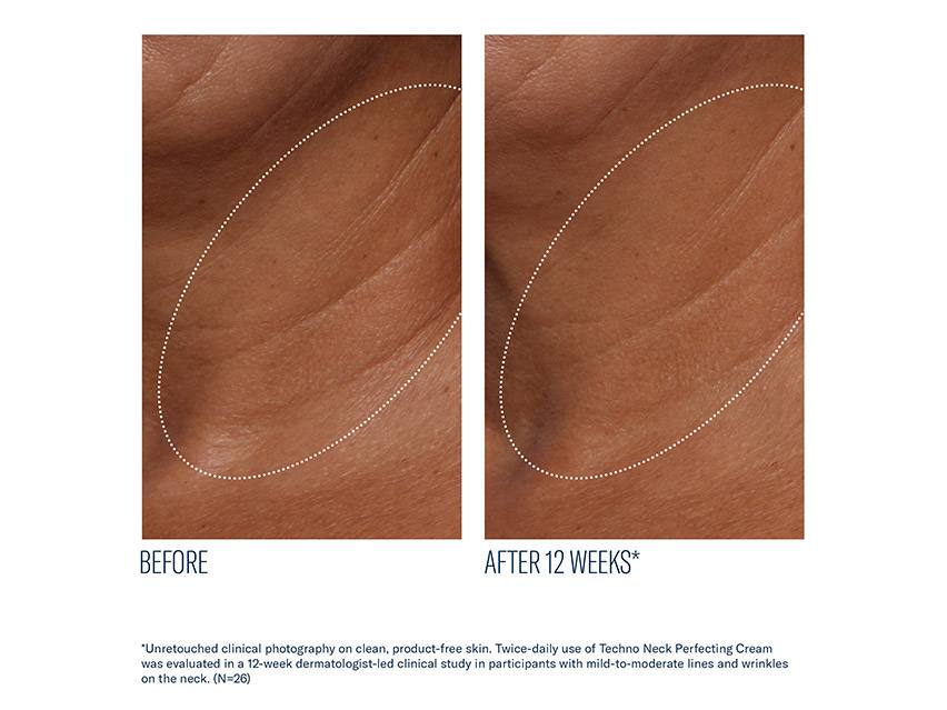 skinbetter science Techno Neck Perfecting Cream