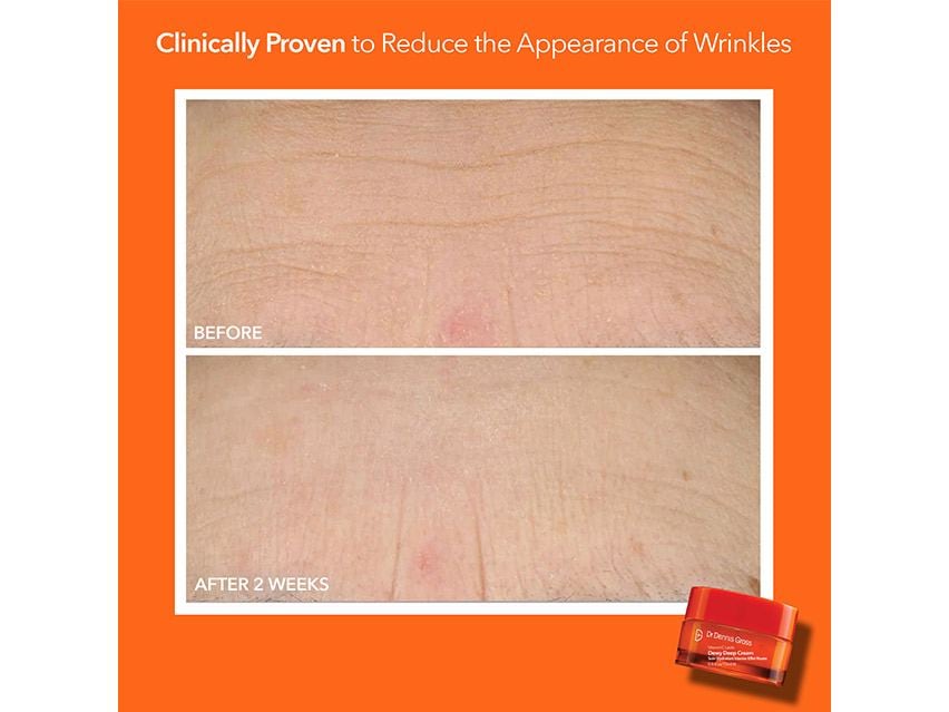 Dr. Dennis Gross Skincare Radiant, Smooth &amp; Firm Universal Daily Peel Kit - Limited Edition