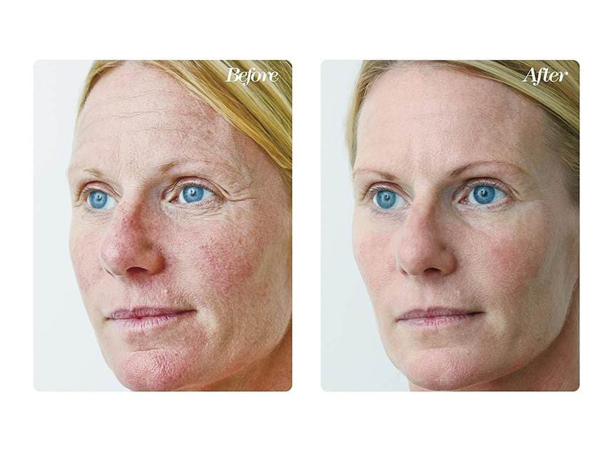 Osmotics Blue Copper 5 Firming Elasticity Repair