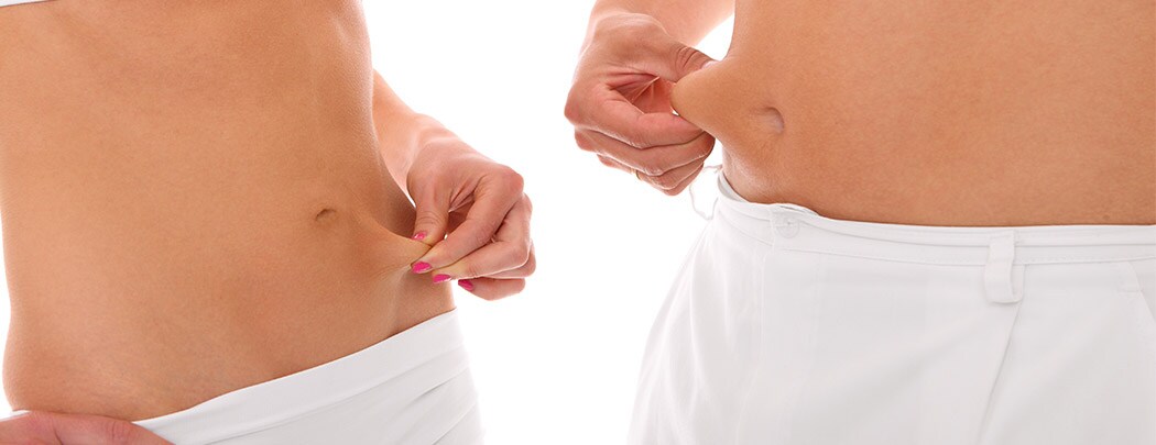 What is tumescent liposuction and SmartLipo?