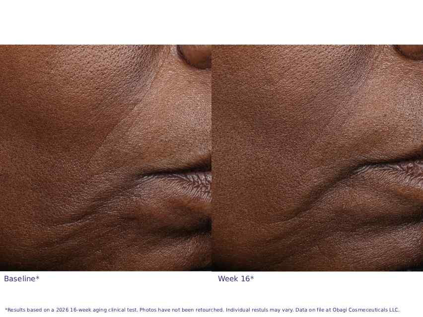 Obagi Professional-C 20% Vitamin C Antioxidant Serum
