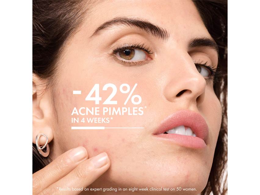 Vichy Normaderm Acne Control Daily Moisturizer