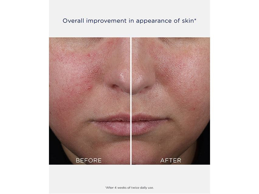 NEOSTRATA Clarify Mandelic Clarifying Hydragel