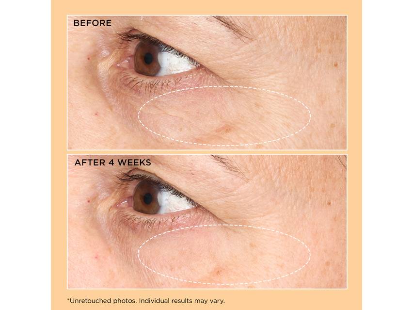 Perricone MD Neuropeptide Corrective Brightening Under-Eye Cream