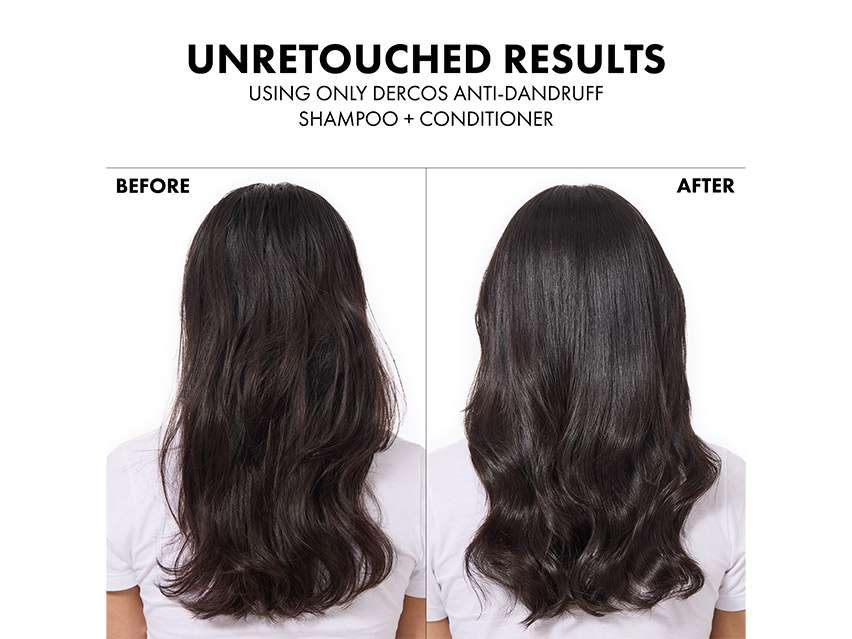 Vichy Dercos Selenium Sulfide Anti-Dandruff Shampoo