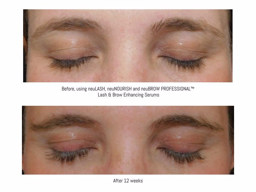 neuLASH/neuBROW PROFESSIONAL™ by Skin Research Laboratories® Introductory Kit