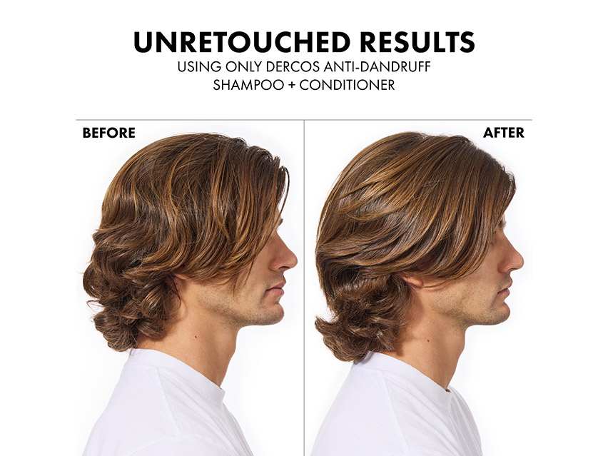 Vichy Dercos Selenium Sulfide Anti-Dandruff Shampoo