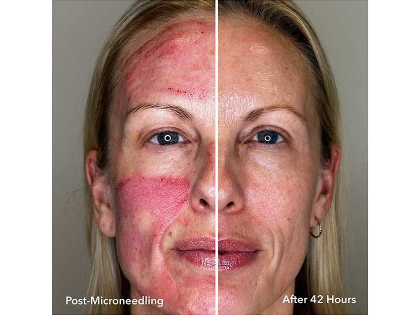 BIOEFFECT 3XGF Recovery Serum