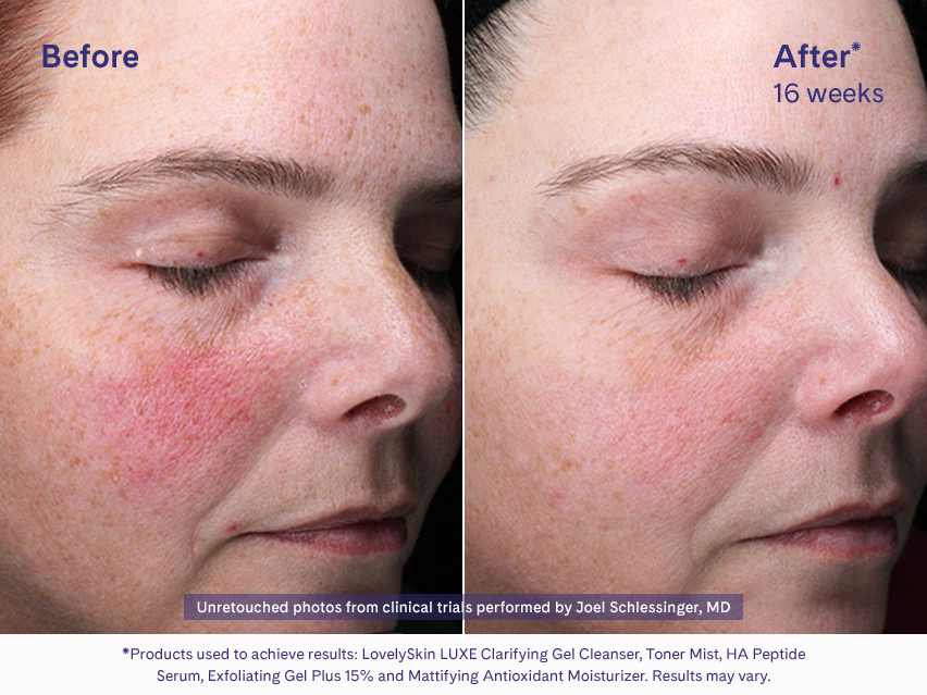 LovelySkin LUXE Mattifying Antioxidant Moisturizer