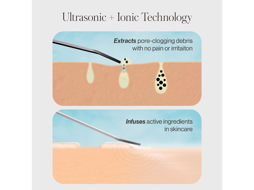 DERMAFLASH DERMAPORE+ Ultrasonic Pore Extractor &amp; Skincare Infuser