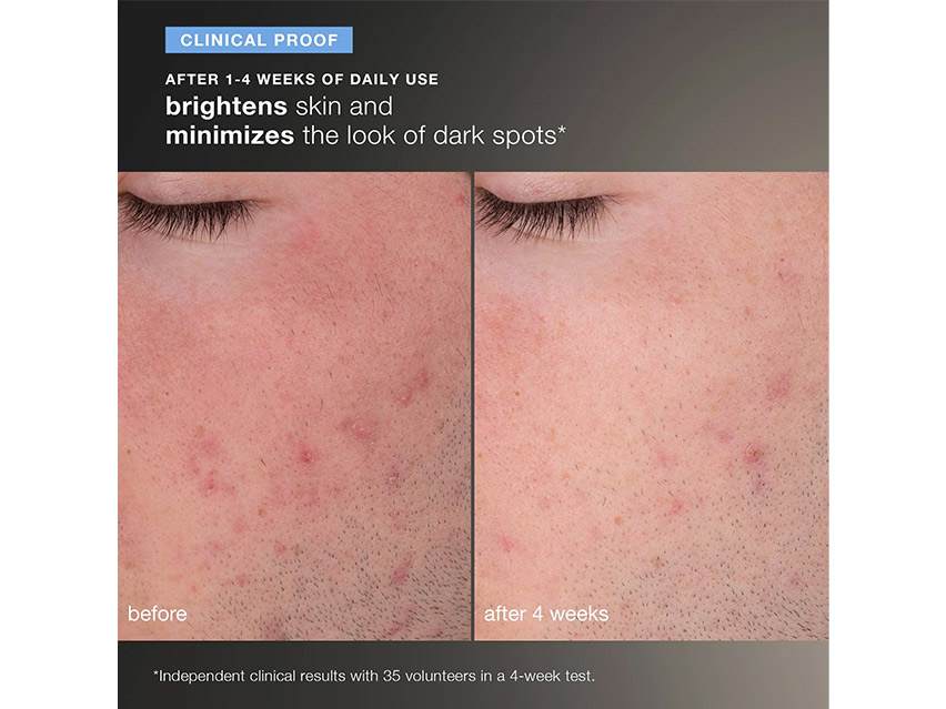 Dermalogica Daily Microfoliant