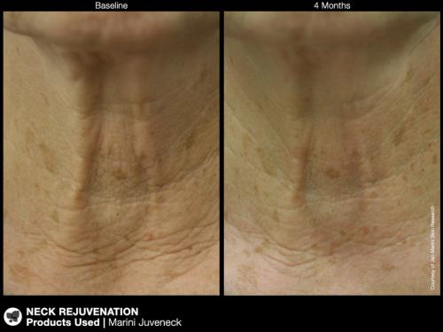 jan marini juveneck neck cream