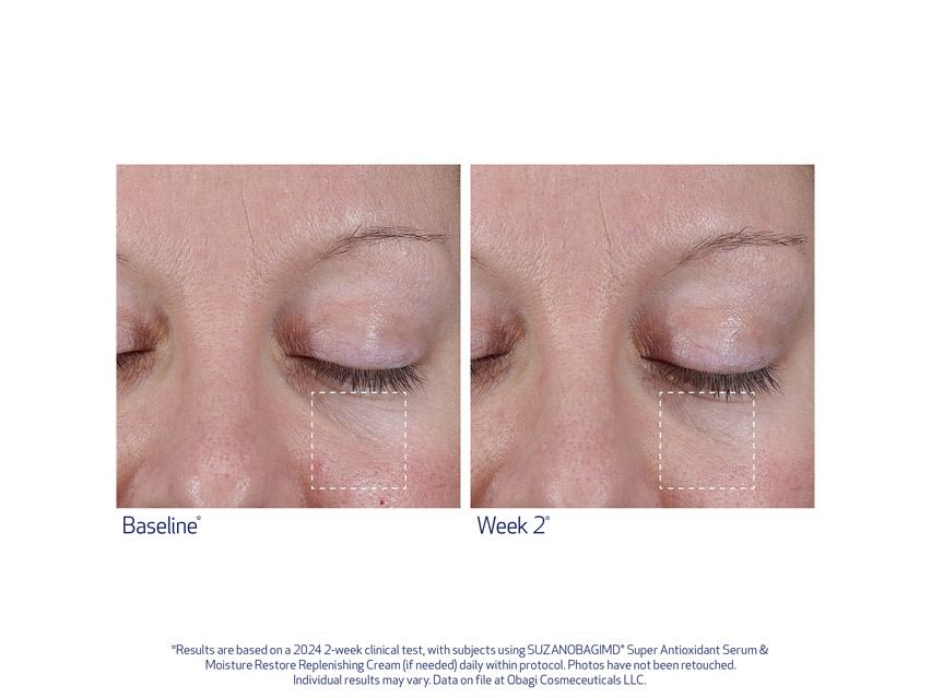 SUZANOBAGIMD Super Antioxidant Serum