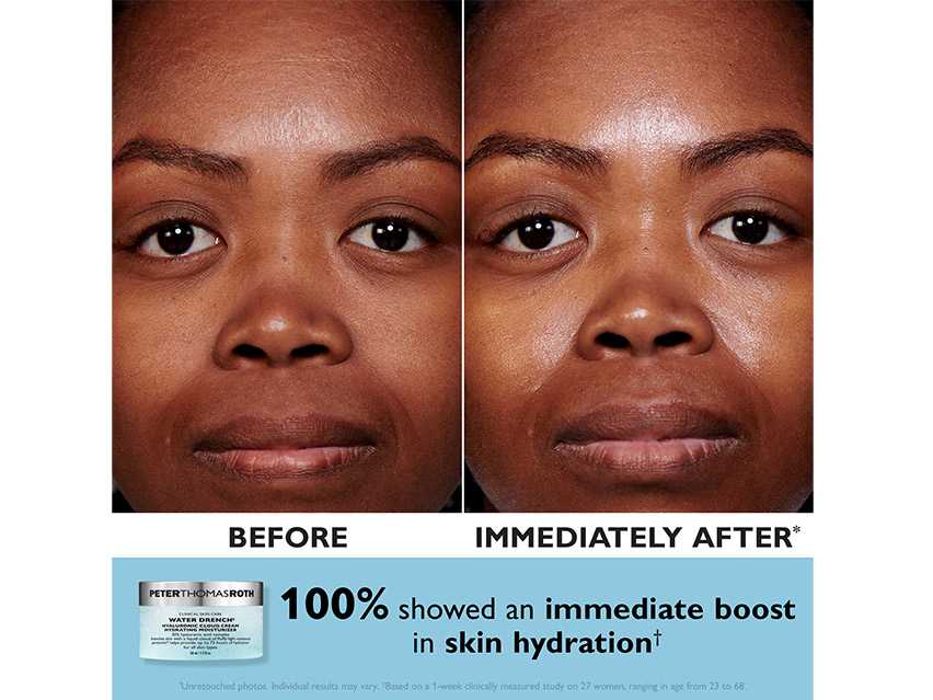 Peter Thomas Roth Day &amp; Night Cloud Cream Set - Limited Edition