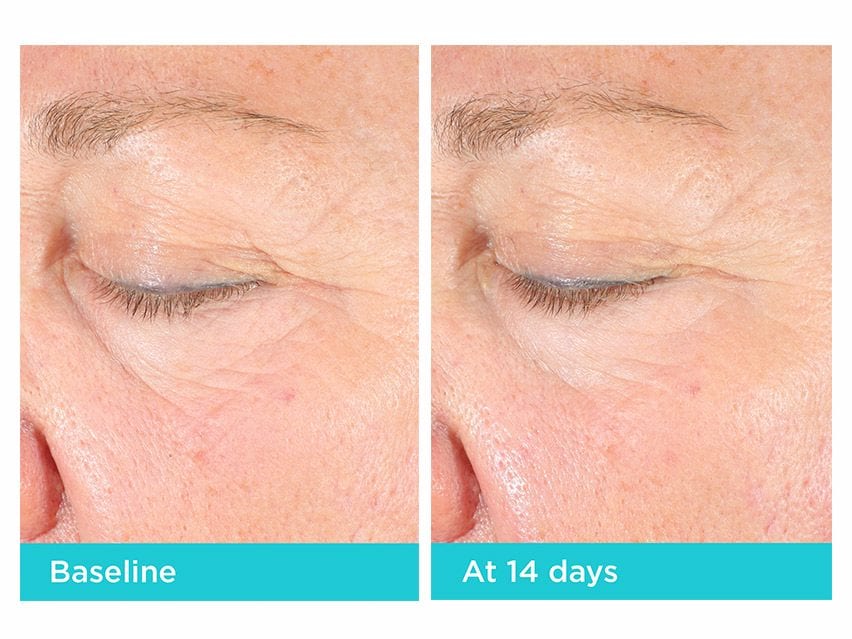 Neocutis Lumière Firm Illuminating & Tightening Eye Cream Before and after